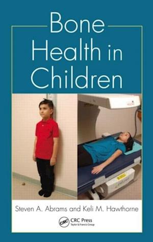 Bone Health in Children