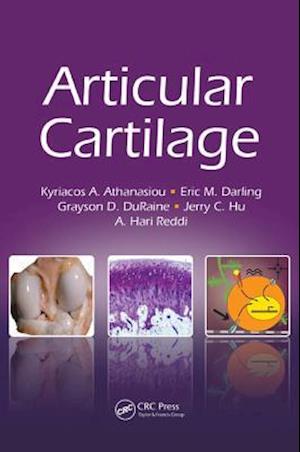 Articular Cartilage