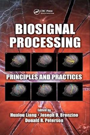 Biosignal Processing
