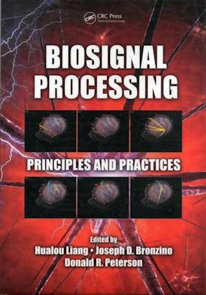 Biosignal Processing