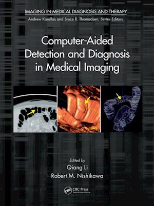 Computer-Aided Detection and Diagnosis in Medical Imaging