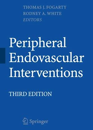 Peripheral Endovascular Interventions