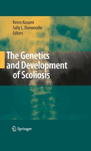 Genetics and Development of Scoliosis