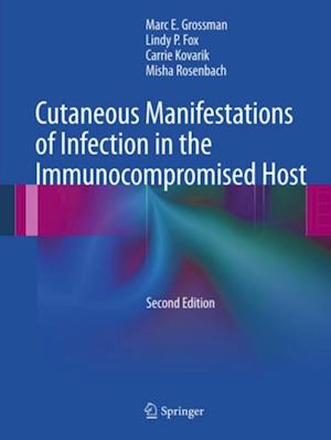 Cutaneous Manifestations of Infection in the Immunocompromised Host