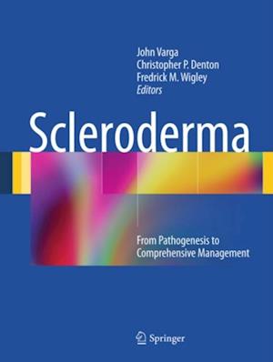 Scleroderma