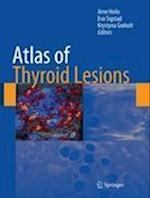 Atlas of Thyroid Lesions