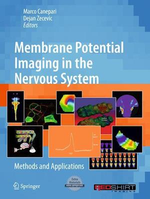 Membrane Potential Imaging in the Nervous System