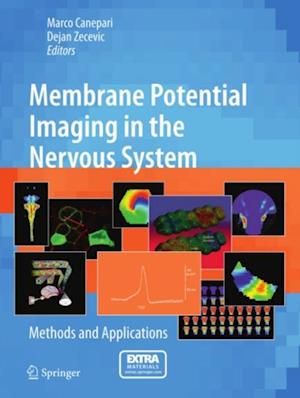 Membrane Potential Imaging in the Nervous System