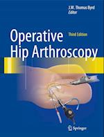 Operative Hip Arthroscopy