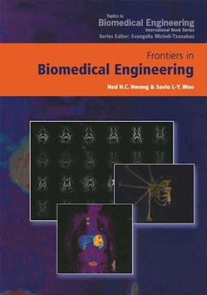 Frontiers in Biomedical Engineering