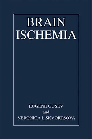 Brain Ischemia