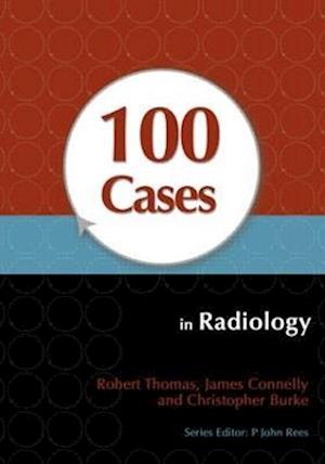 100 Cases in Radiology