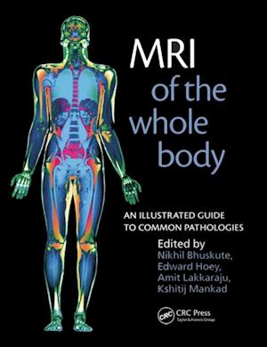 MRI of the Whole Body