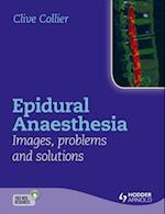 Epidural Anaesthesia: Images, Problems and Solutions