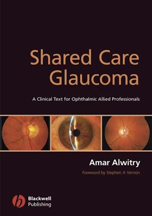 Shared Care Glaucoma