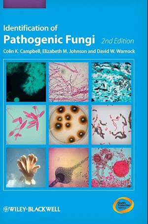Identification of Pathogenic Fungi 2e