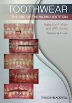 Toothwear – The ABC of the Worn Dentition