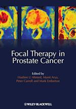 Focal Therapy in Prostate Cancer