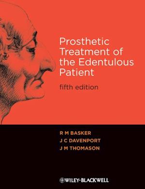 Prosthetic Treatment of the Edentulous Patient