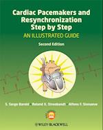 Cardiac Pacemakers and Resynchronization Step by Step