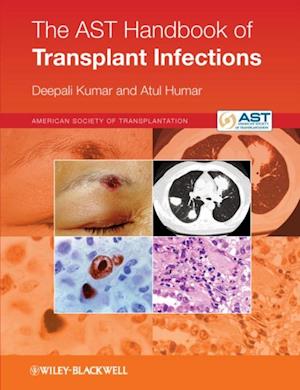 AST Handbook of Transplant Infections