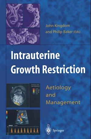 Intrauterine Growth Restriction