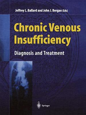 Chronic Venous Insufficiency