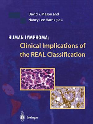 Human Lymphoma: Clinical Implications of the REAL Classification