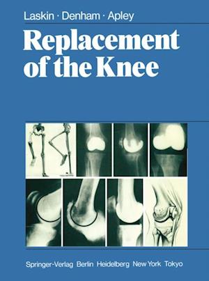 Replacement of the Knee