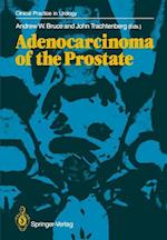 Adenocarcinoma of the Prostate