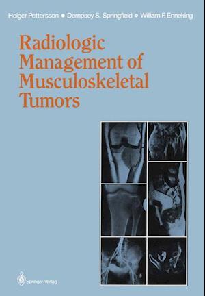 Radiologic Management of Musculoskeletal Tumors