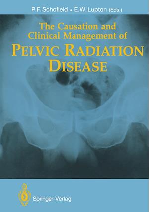 The Causation and Clinical Management of Pelvic Radiation Disease
