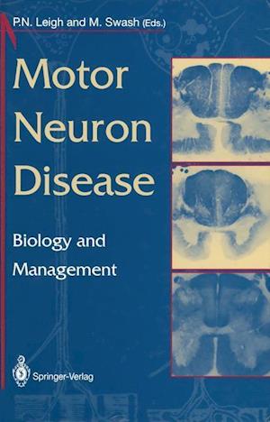 Motor Neuron Disease