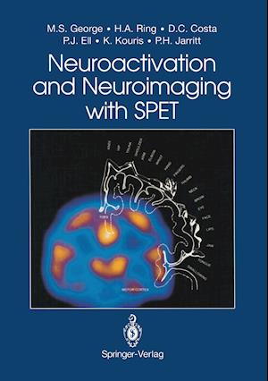 Neuroactivation and Neuroimaging with SPET