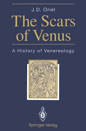 Scars of Venus