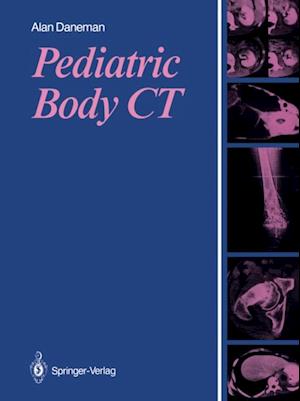 Pediatric Body CT