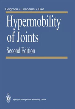 Hypermobility of Joints