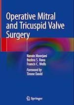 Operative Mitral and Tricuspid Valve Surgery