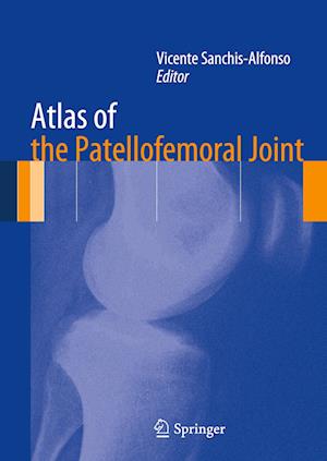 Atlas of the Patellofemoral Joint