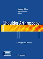 Shoulder Arthroscopy