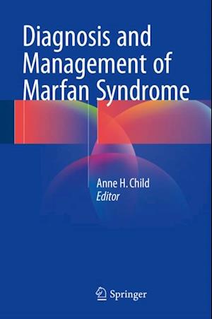 Diagnosis and Management of Marfan Syndrome