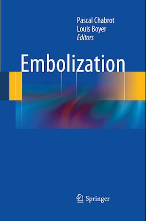 Embolization