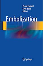 Embolization