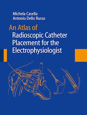 An Atlas of Radioscopic Catheter Placement for the Electrophysiologist