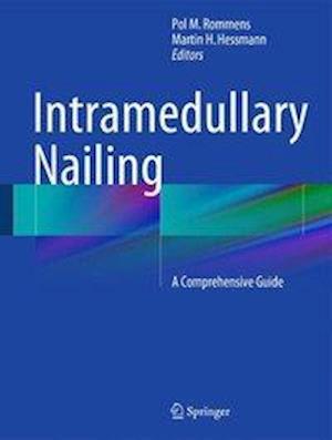 Intramedullary Nailing