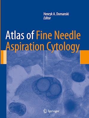 Atlas of Fine Needle Aspiration Cytology