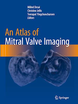 An Atlas of Mitral Valve Imaging