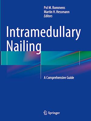 Intramedullary Nailing