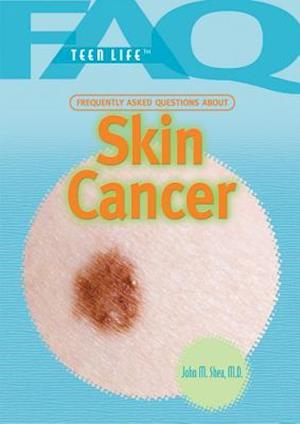Frequently Asked Questions about Skin Cancer