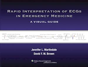 Rapid Interpretation of ECGs in Emergency Medicine